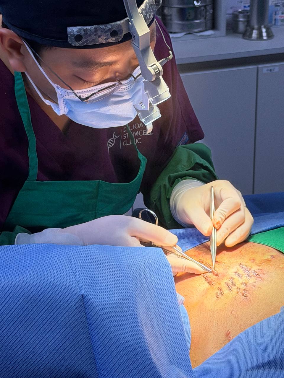 켈로이드 치료, 왜 ‘흉터를 보는 전문의’가 중요한가